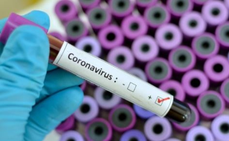 287 са новите случаи на коронавирус у нас сочат данните